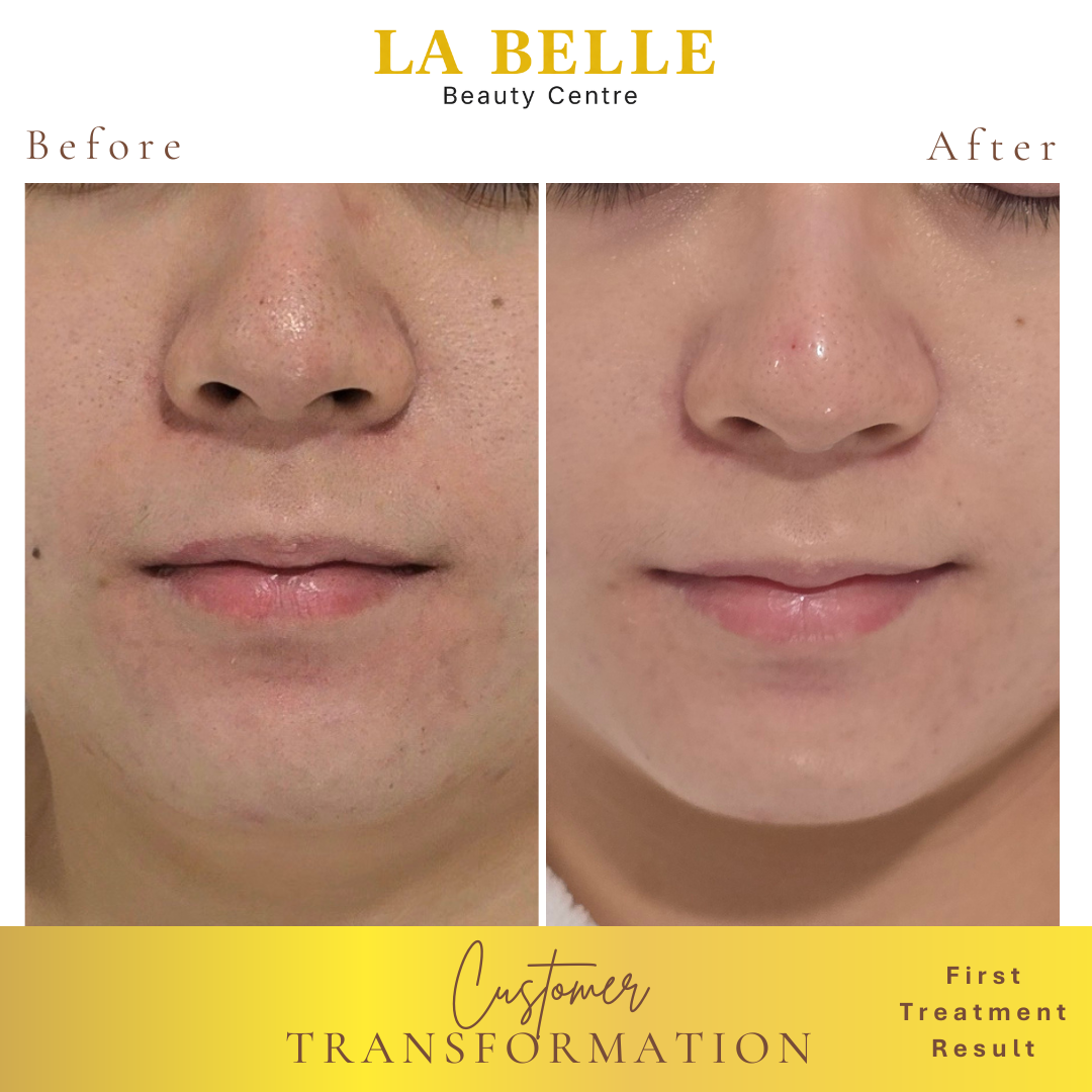 Ms. Lim Transformation Result